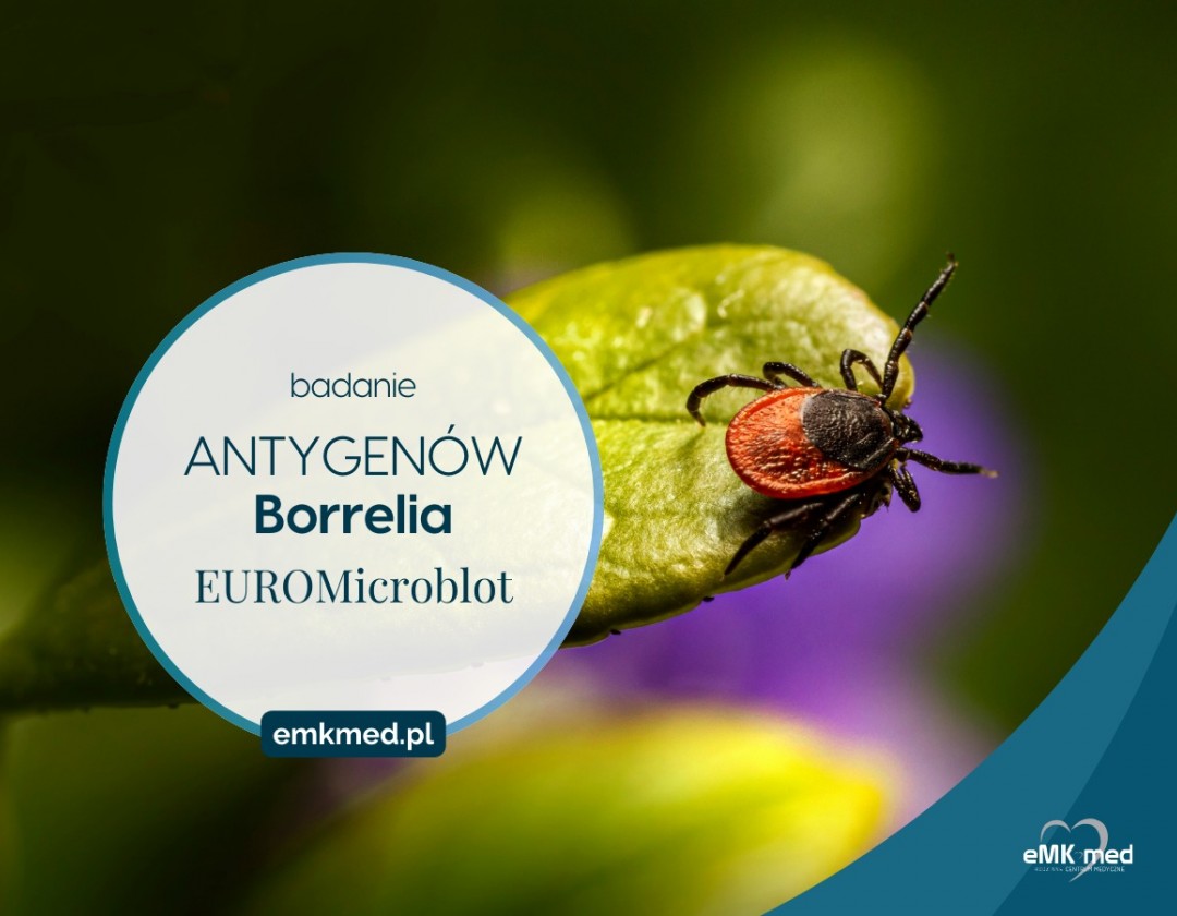 Nowa metoda EUROMicroblot: rewolucyjne badanie przeciwko antygenom Borrelia