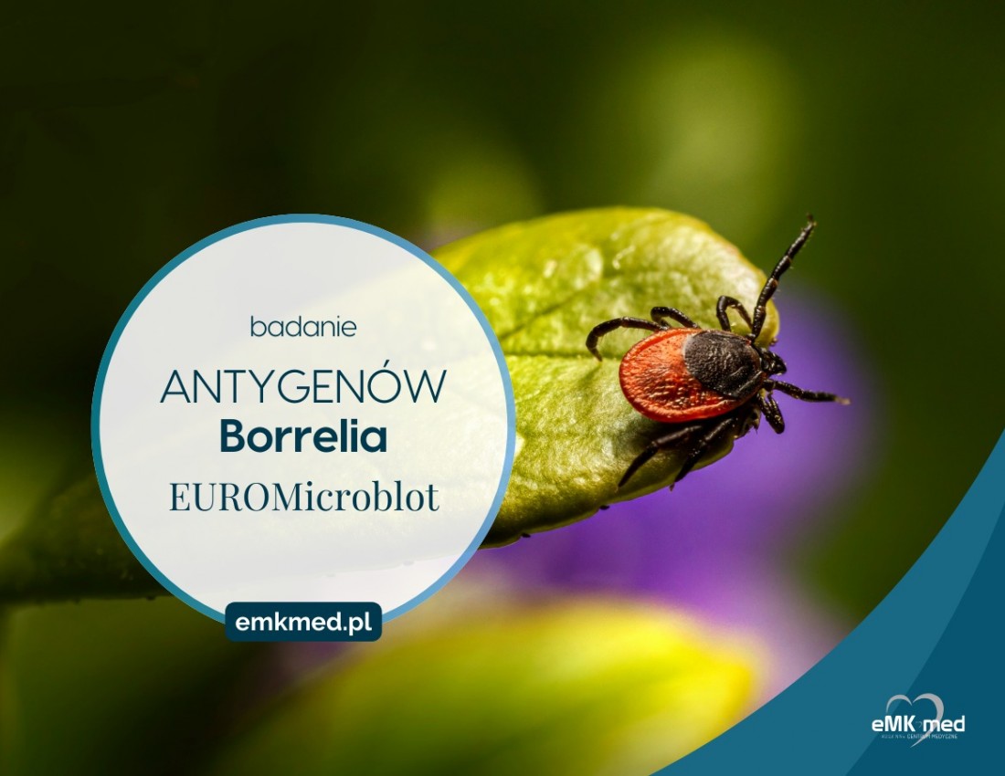 Nowa metoda EUROMicroblot: rewolucyjne badanie przeciwko antygenom Borrelia